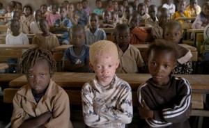 Un garçon albinos retrouvé démembré au Burundi